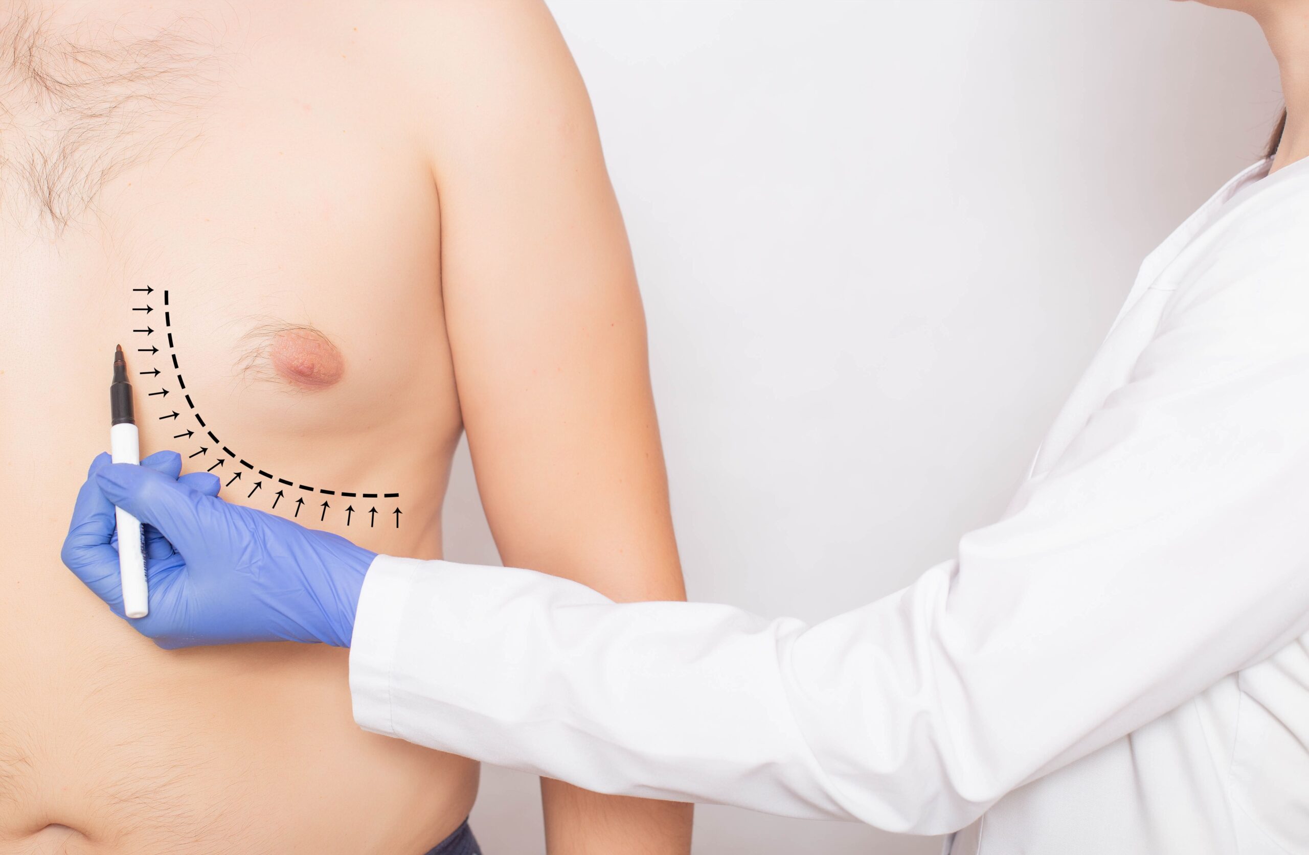 Man boobs, gyno or moobs: What do you call male breasts? - LA